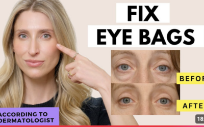 How to reduce eye bags over 50 according to a dermatologist